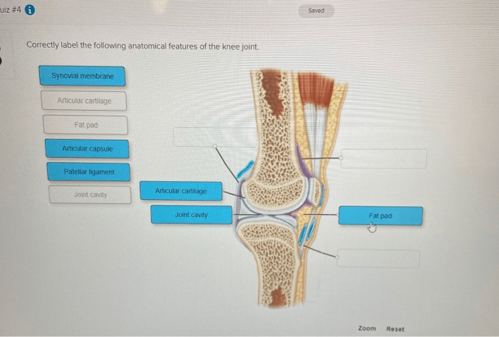 Correctly label the following anatomical features of the talocrural joint