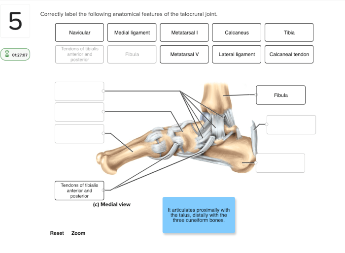 Correctly label the following anatomical features of the talocrural joint